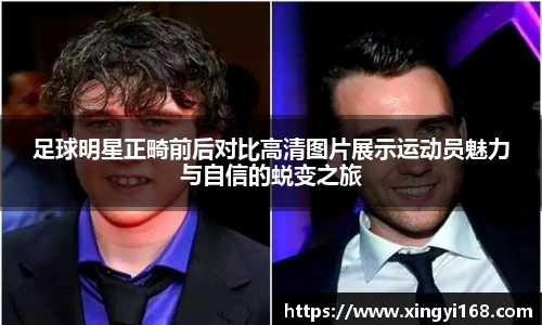 足球明星正畸前后对比高清图片展示运动员魅力与自信的蜕变之旅